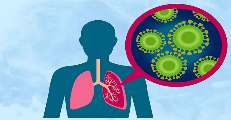 শীতে নিউমোনিয়ায় সতর্কতা জরুরি