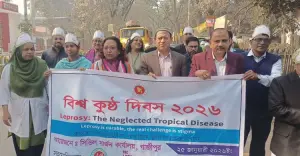 গাজীপুরে ৮ বছরে ৪২৭ জন কুষ্ঠ রোগী সনাক্ত