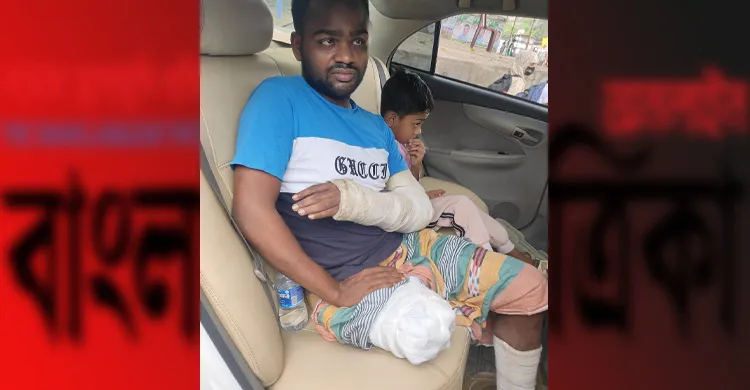 চাঁদা না পেয়ে ঠিকাদারকে মারধরে কেটে ফেলতে হয়েছে একটি পা, বিচার দাবি