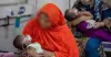 হামের উপসর্গে আরও ৫ শিশুর মৃত্যু, আক্রান্ত ৮৭৭