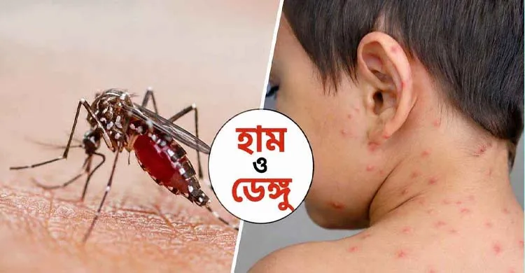 থামছে না মৃত্যু মিছিল, একদিনে ডেঙ্গু ও হামে ঝরল ১৮ প্রাণ
